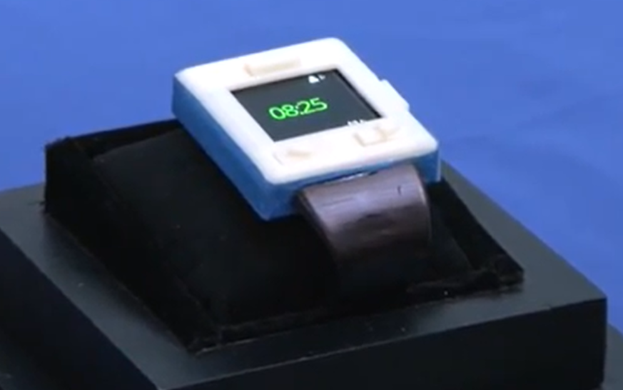 Alzheimer Smart Watch